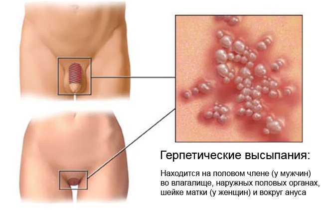 народные средства от запаха изо рта отзывы народные средства от запаха изо рта отзывы